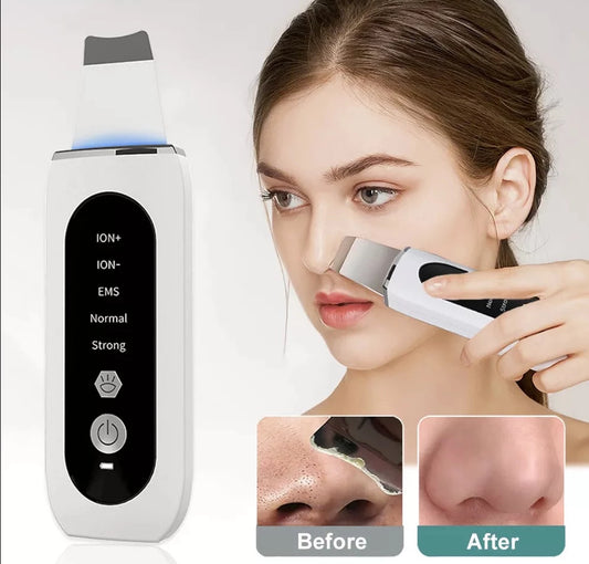 Ultrasonic Skin Blackhead Remover