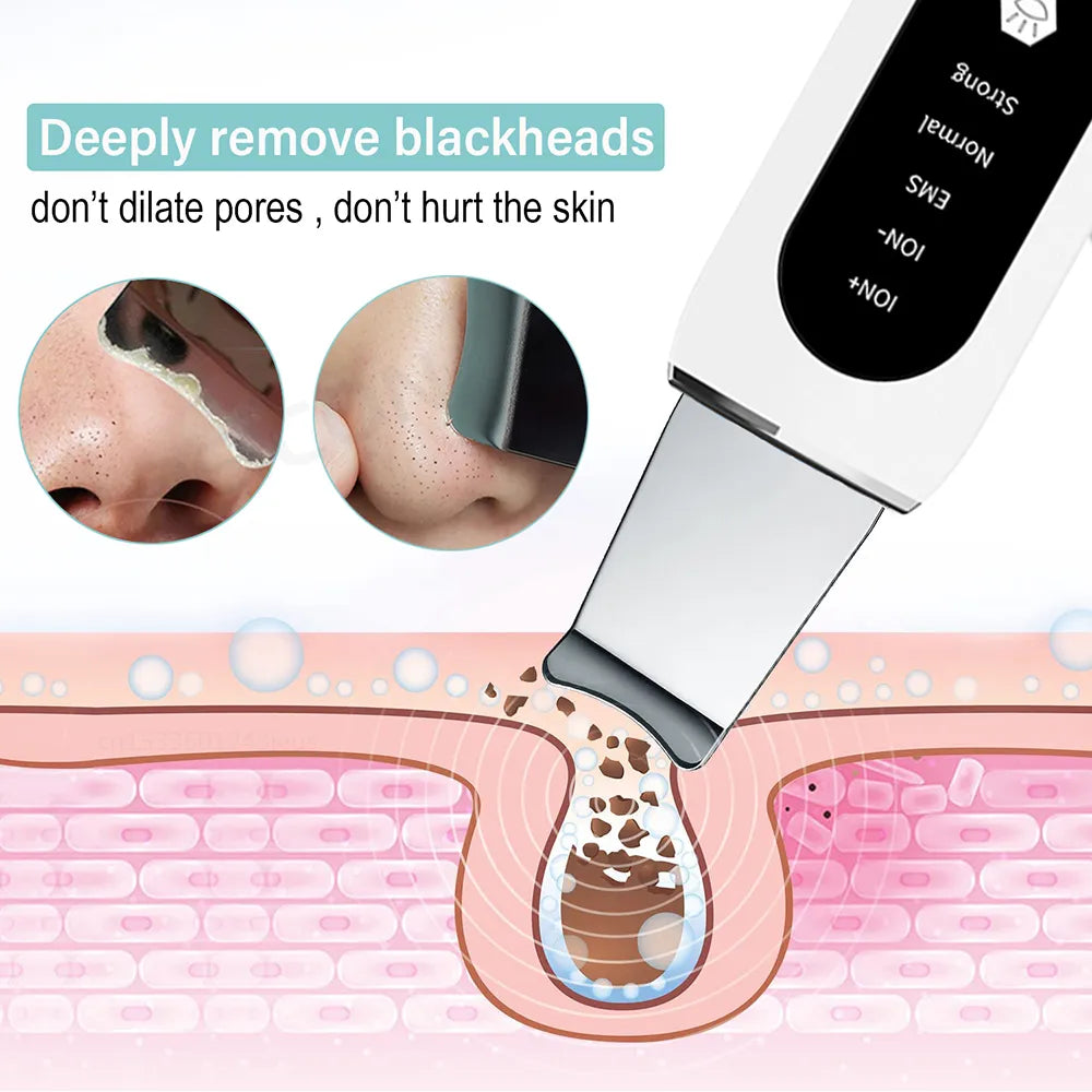 Ultrasonic Skin Blackhead Remover