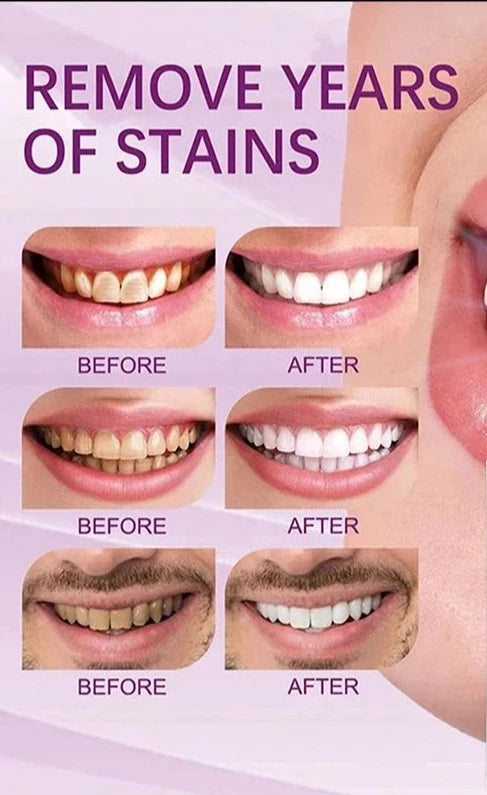 Purple Toothpaste Teeth Whitening